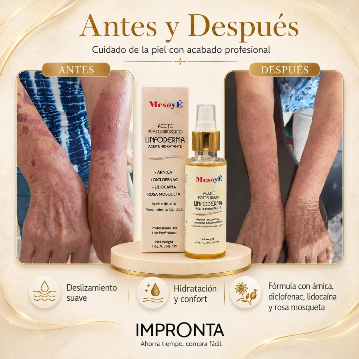 Aceite Linfodema 4 onz.